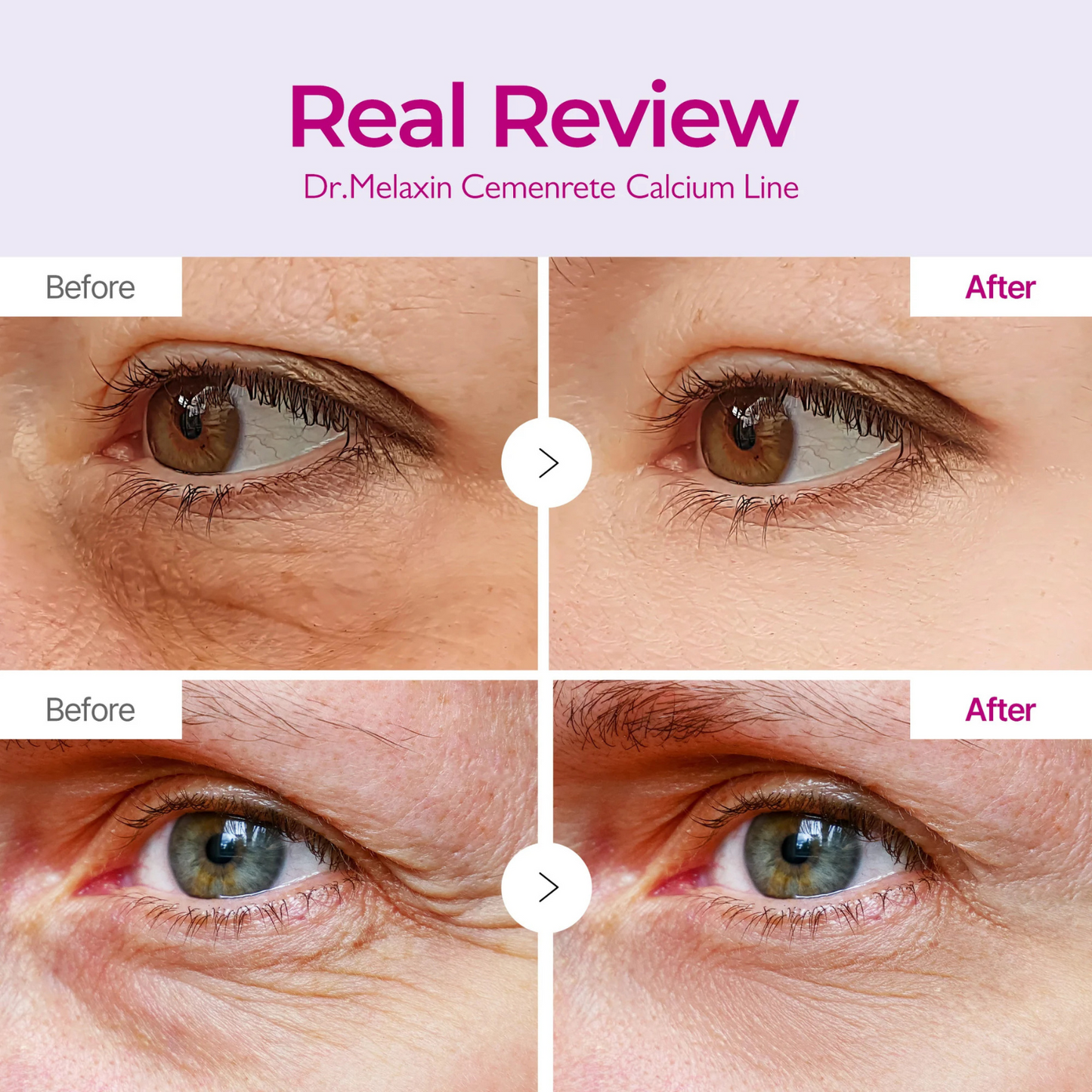 Dr. Melaxin Lift Balm & Eye Patches Kit