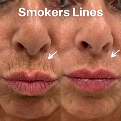 Korean Skincare Lift Balm*